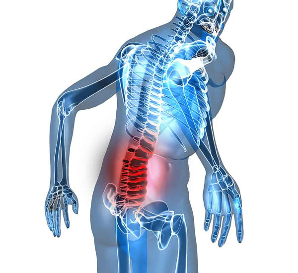 Triệu chứng của đau thắt lưng?