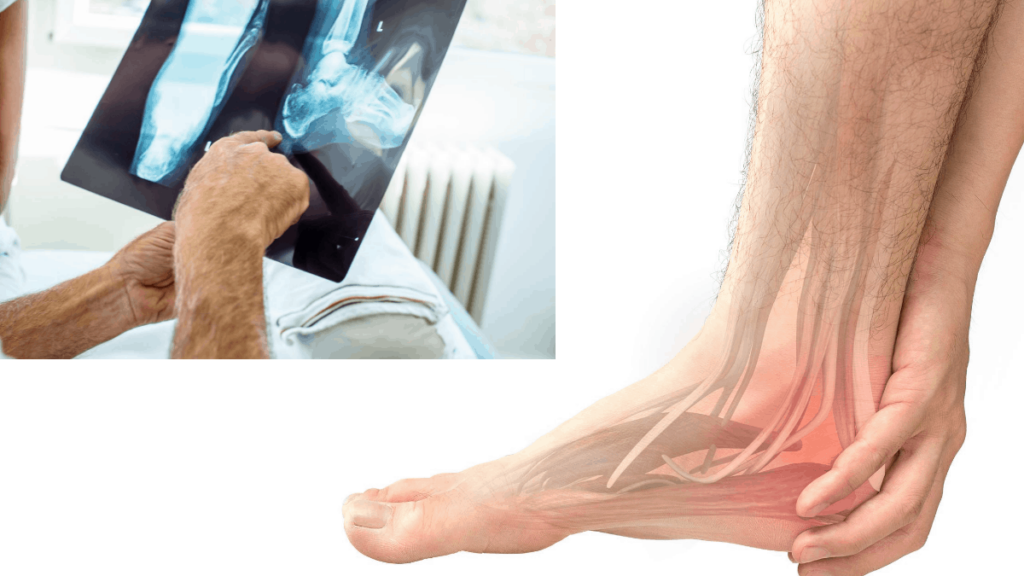 khắc phục đau gót chân tại nhà